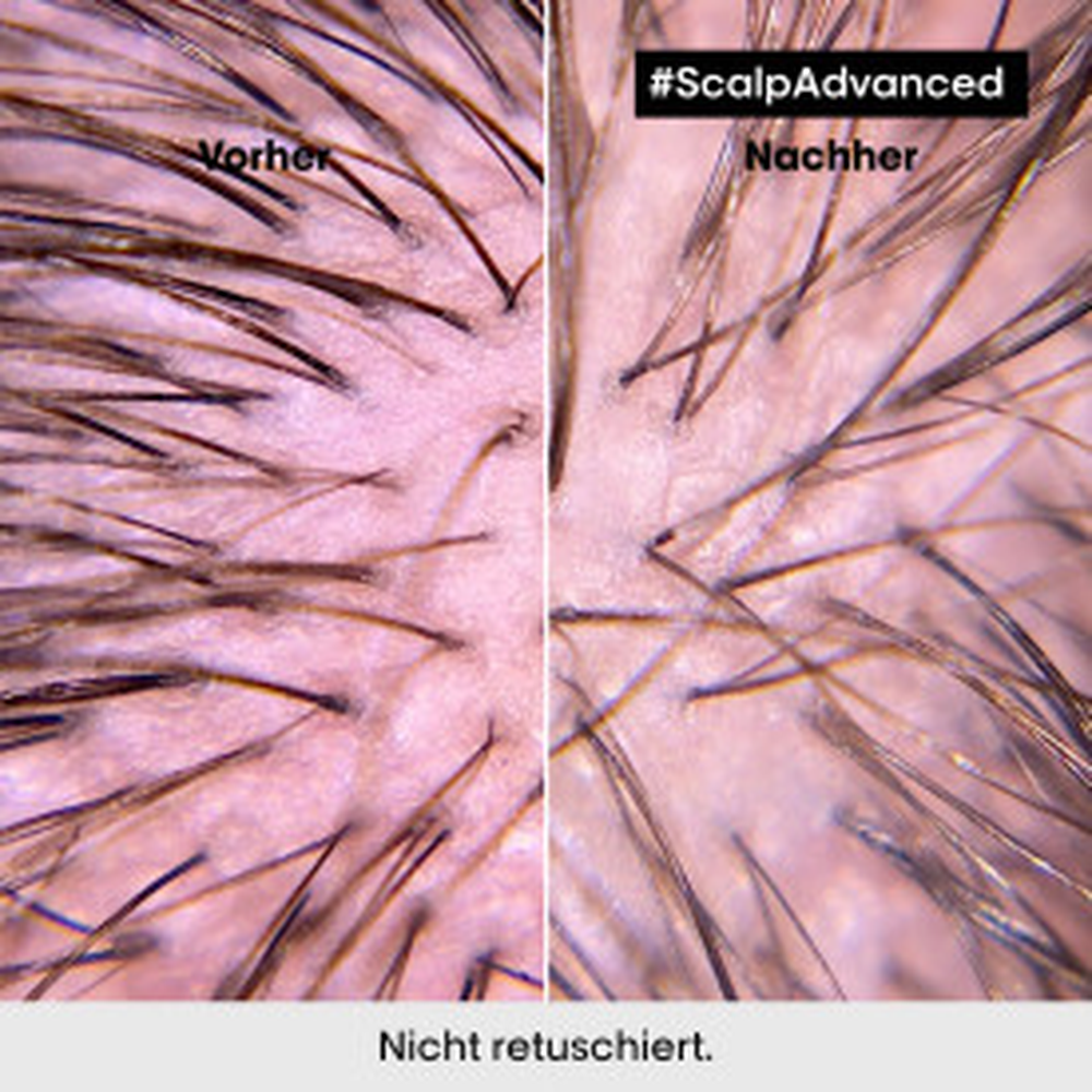 Anti-Discomfort Intense Soother Treatment 200ml-PFLEGE-L'Oréal-TipTopPreis GmbH