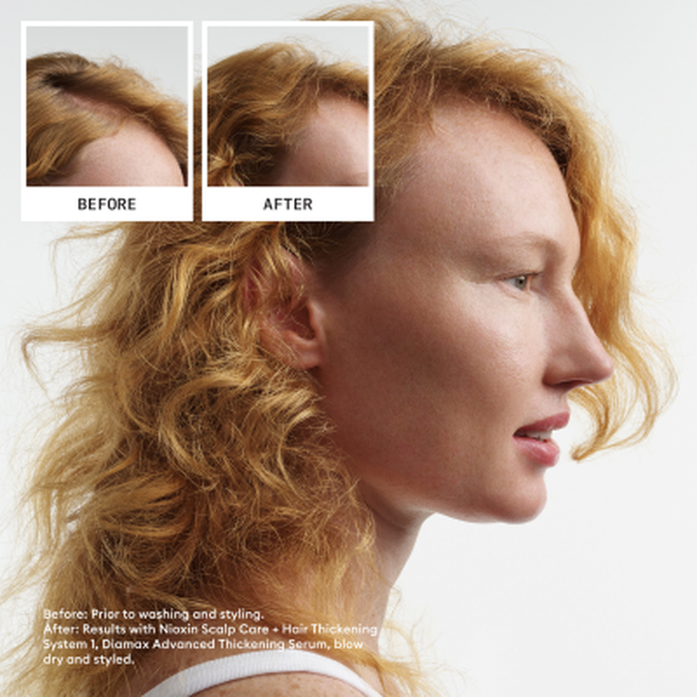 Nioxin System 1 Conditioner-PFLEGE-Wella-300ml-TipTopPreis GmbH