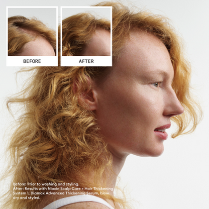 Nioxin System 1 Conditioner-PFLEGE-Wella-300ml-TipTopPreis GmbH