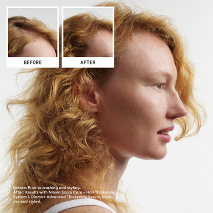 Nioxin System 1 KIT-PFLEGE-Wella-350ml-TipTopPreis GmbH